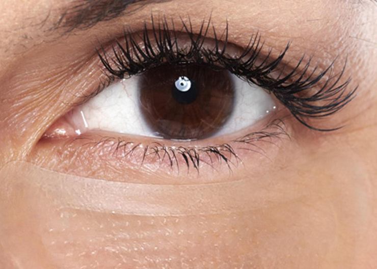 rimedio casalingo cancella occhiaie